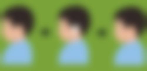 成都军建医院疤痕修复靠谱吗？