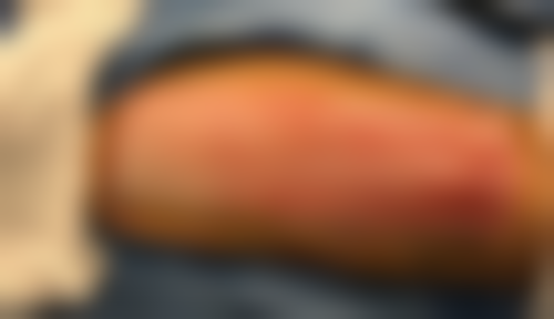 乌鲁木齐安婕丽诗整形美容预约挂号方式