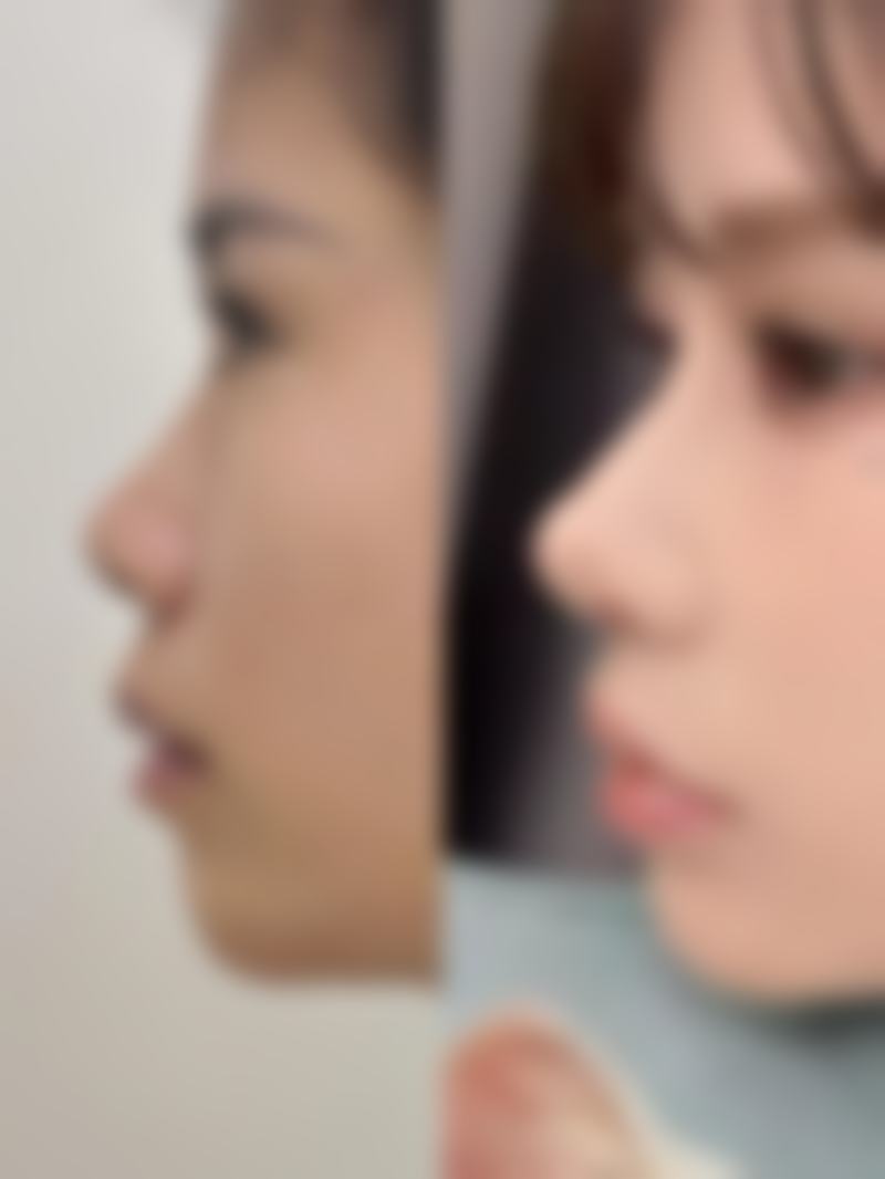 面部疤痕怎么去除小妙招？揭秘5种医美手法，安全无痛高效祛疤，你还在等什么？ 