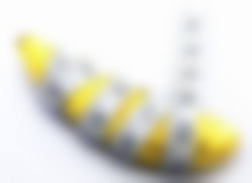 沈阳名流美容医院调宽埋线双眼皮适合吗