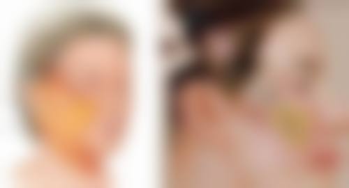 沈阳杏林整形外科医院治疗疤痕增生止痛靠谱吗