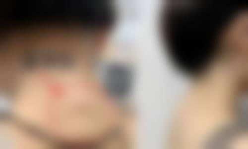 余姚树兰整形医院预约挂号方式:多种途径任你选