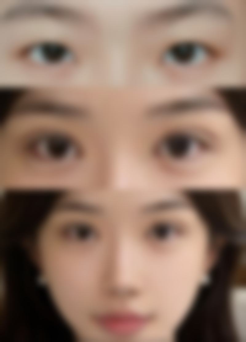 合肥丹凤朝阳妇科医院整形科价格表:透明消费美丽无负担