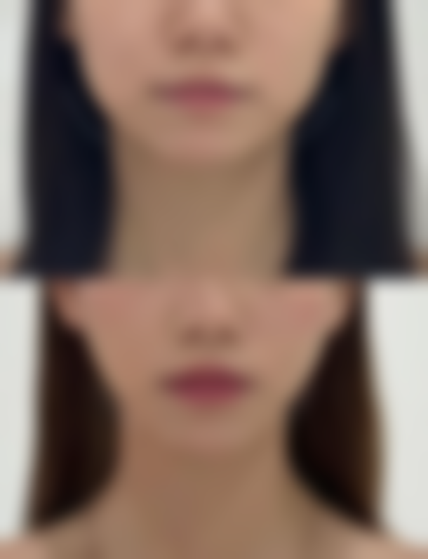 衡阳溦美医疗美容门诊部仪器设备