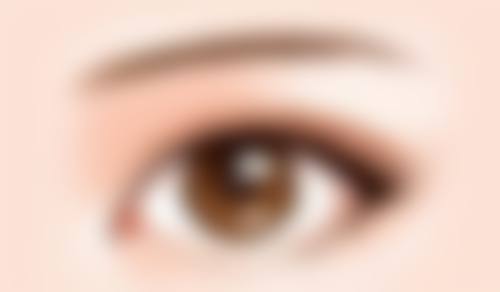 杭州薇琳医美机构改善假体隆胸后半年还特别硬值不值