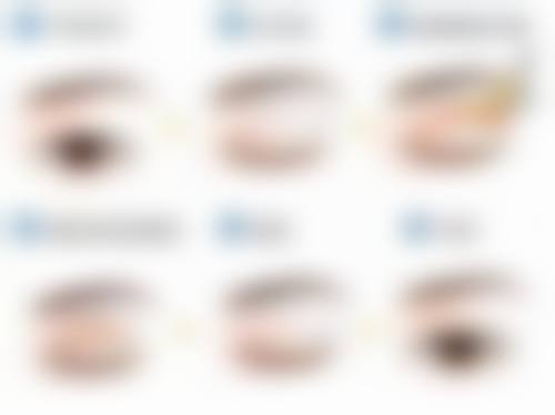 曾春云医生技术特点：个性化多点注射