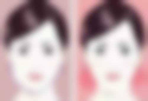 呼和浩特京美医疗美容医院做埋线后全切双眼皮靠谱吗？