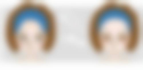 南阳华美医疗美容门诊部解决假体隆胸后半年还特别硬靠谱吗