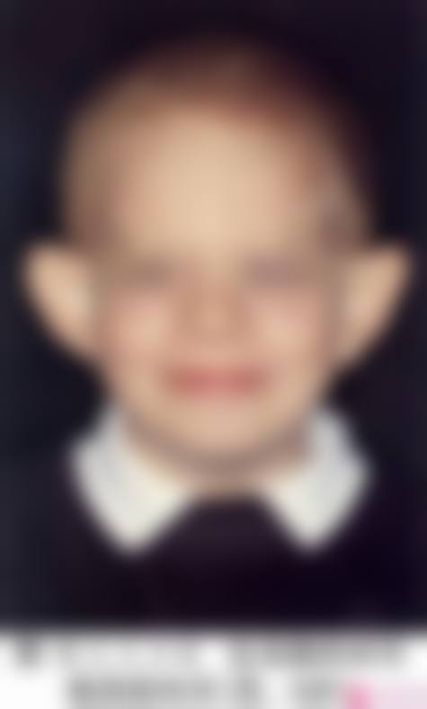 贵阳中医学校第一附属医院整形科真实实例:见证美丽奇迹