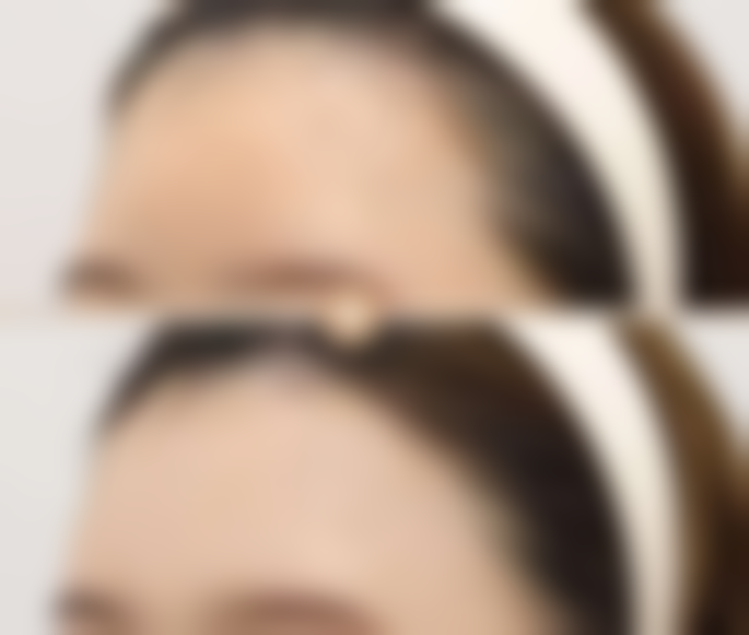 刘科源医生看诊优势