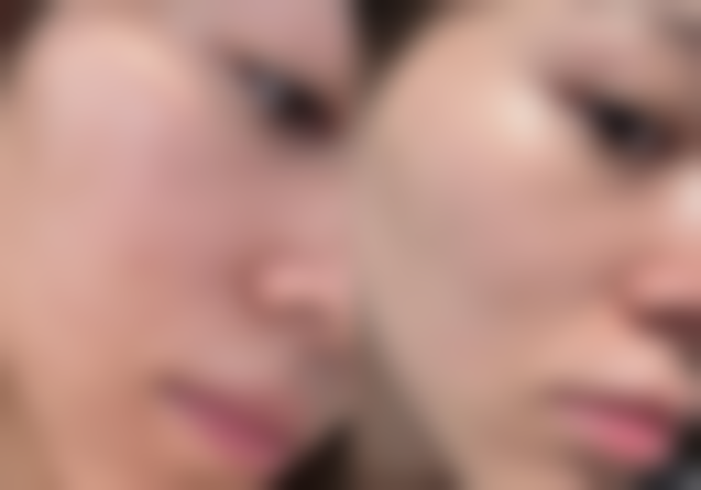 运城光子医疗美容门诊部仪器设备