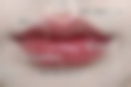 北京嘉禾医疗美容吸脂口修复慢怎么办？