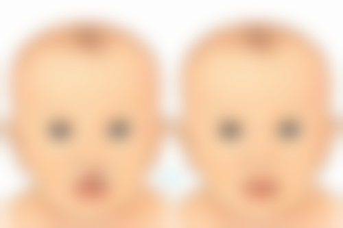 北京嘉禾医疗美容做完双眼皮喝咖啡对修复影响大吗？