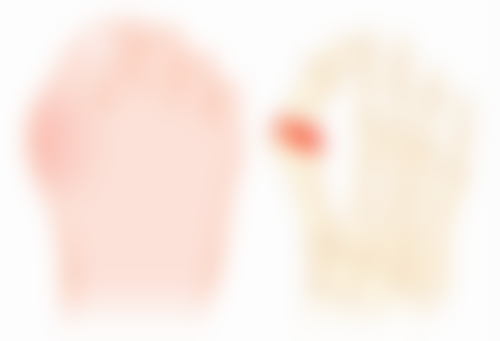 吸脂口多久可以恢复？医生揭秘影响恢复时长关键因素，7 成受术者 1 个月显著恢复秘诀大公开！ 