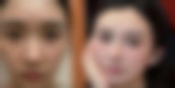 包头市第八医院（医疗美容科）擅长项目：满足你的多样需求