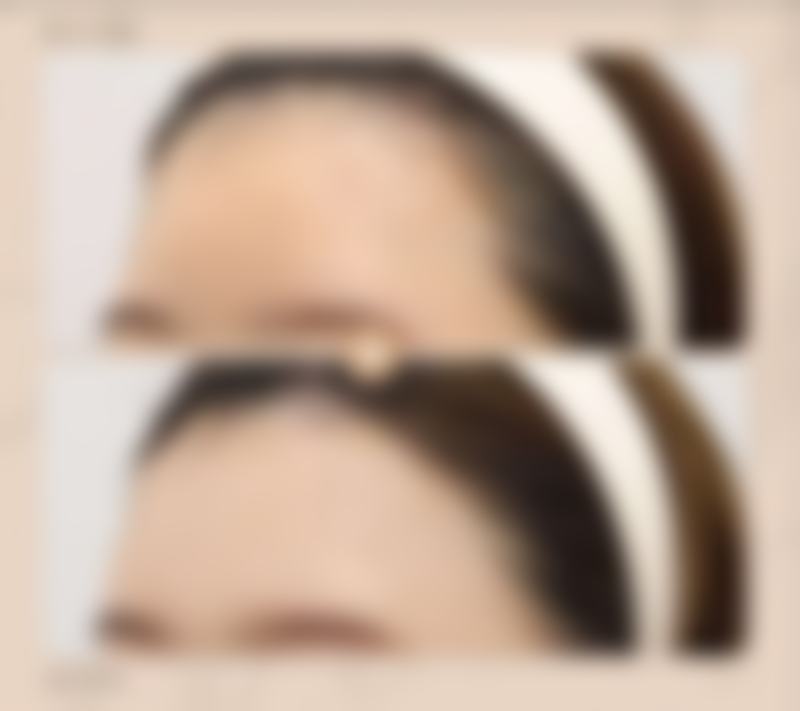 保定市虞美人医疗美容价格表