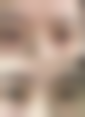 江阴美格尔医疗美容诊所价格表