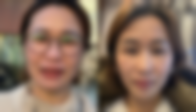 北京禾美嘉医疗美容吸脂口修复受哪些因素影响？