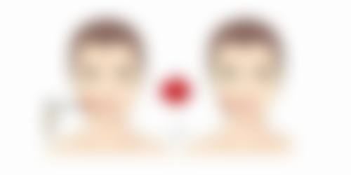 北京丽合医疗美容治疗烫伤疤痕增生靠谱吗？