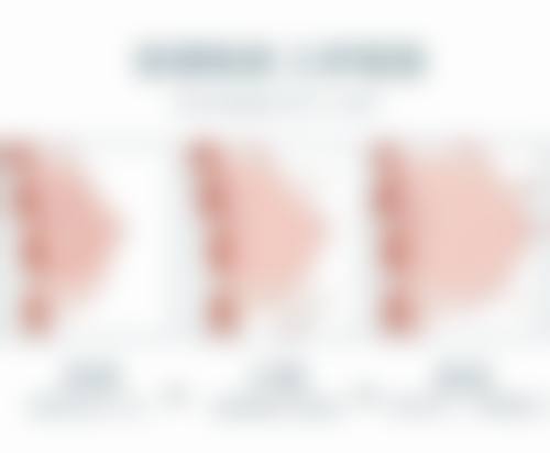 四川成都美容整形医院私密科李挺医生技术靠谱吗