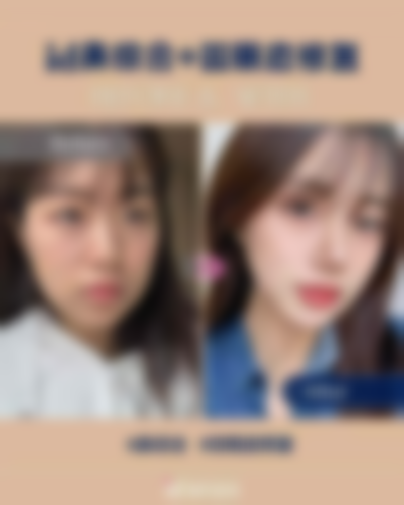 北京禾美嘉医疗美容消除凹进去的红色疤痕靠谱吗？