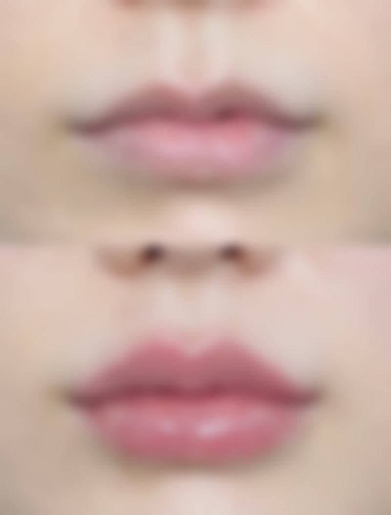 武汉斯启诺医疗美容门诊部彭华伟适合哪些人群