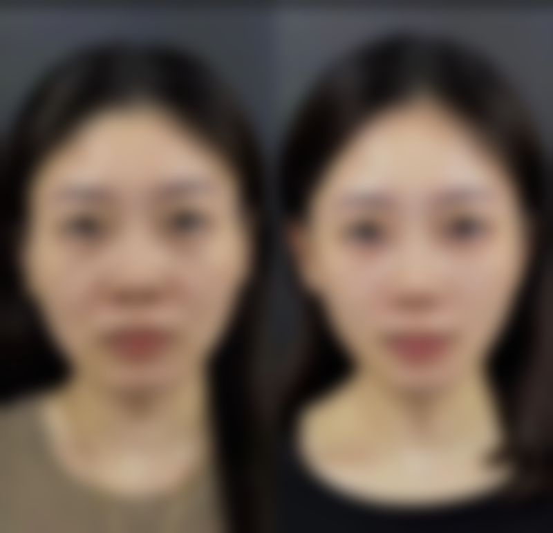 武汉斯启诺医疗美容门诊部彭华伟做精细化眼部整形靠谱吗