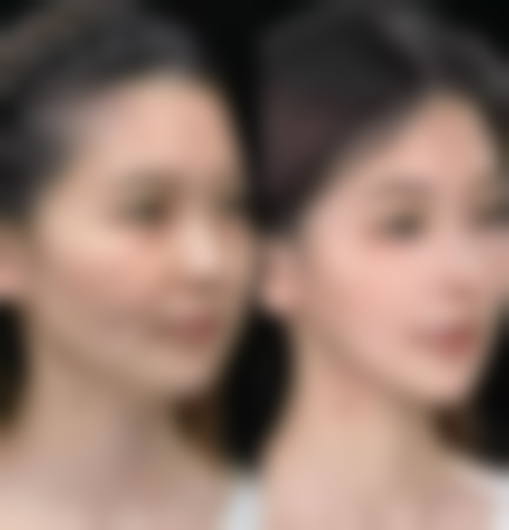 贵州六盘水利美康医疗美容价格表