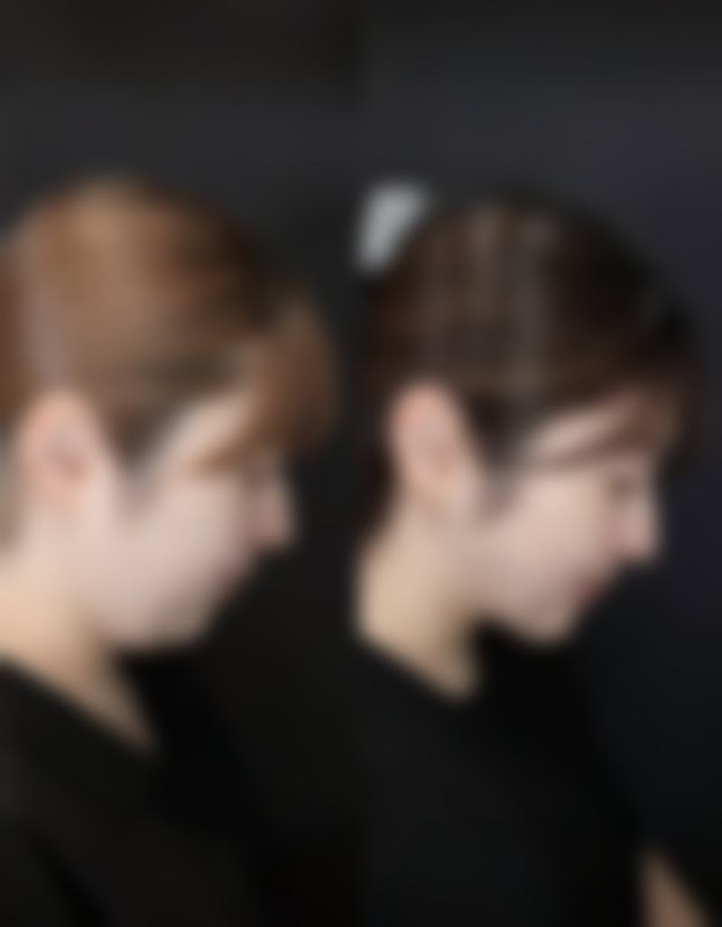 四川成都美容整形医院私密科李挺医生的术后服务值不值