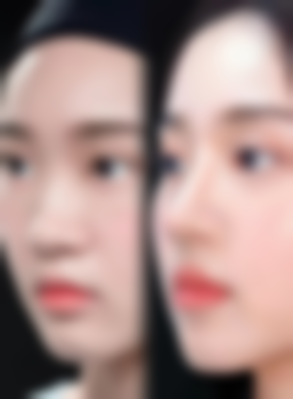 北京加减美医疗美容的环吸和大腿抽脂修复期怎么样？