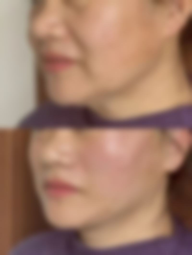 武汉斯启诺医美仪器抗衰预约挂号方式