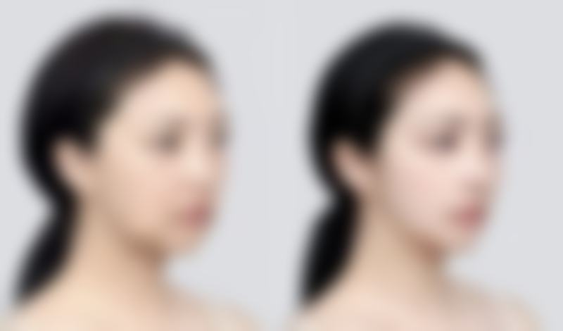 四川成都美容整形医院私密科李挺医生的术前沟通值得信赖吗