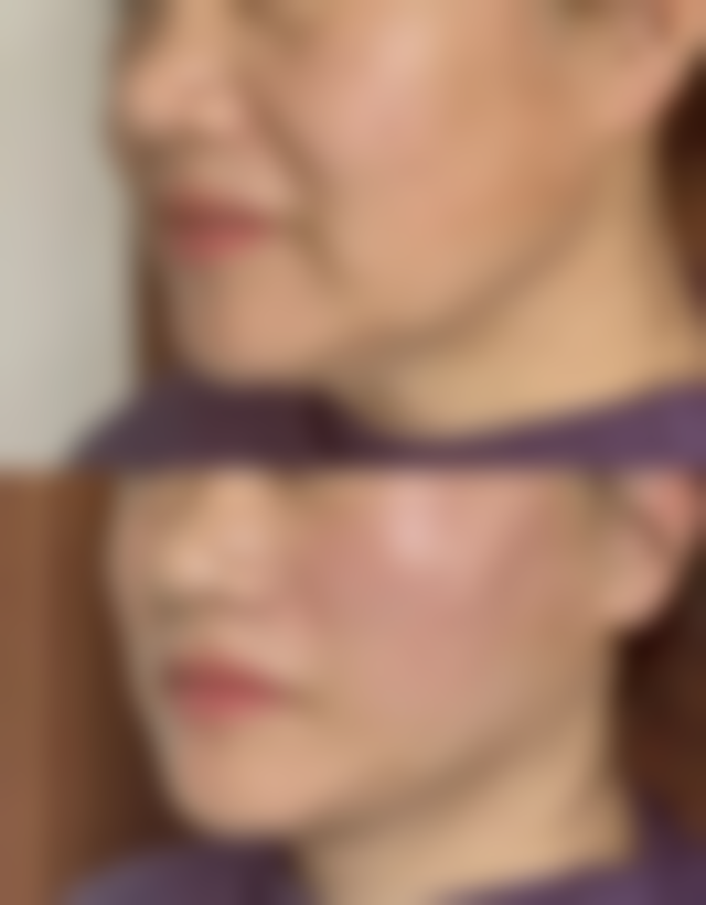 深圳美洛斯医疗美容诊所真实实例：见证美丽蜕变