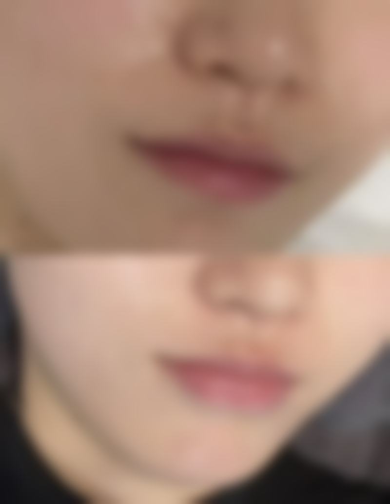 四川成都美容整形医院私密科李挺医生对隐私保护到位吗