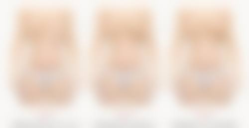 西安画美医疗美容医院线提升隆鼻变宽后如何处理适合吗