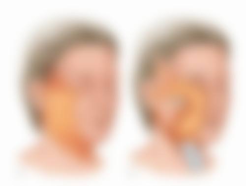 沈阳杏林整形去眼袋靠谱吗？