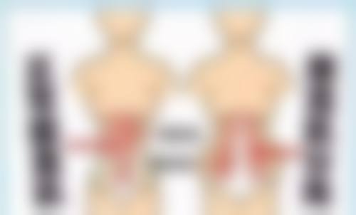 沈阳杏林整形割眼袋适合哪些人