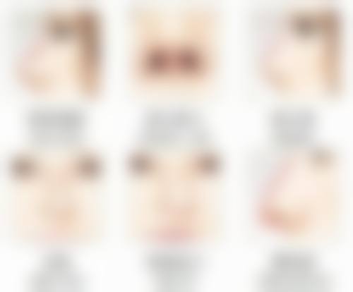 泉州海峡医疗美容门诊部注射瘦脸针靠谱吗