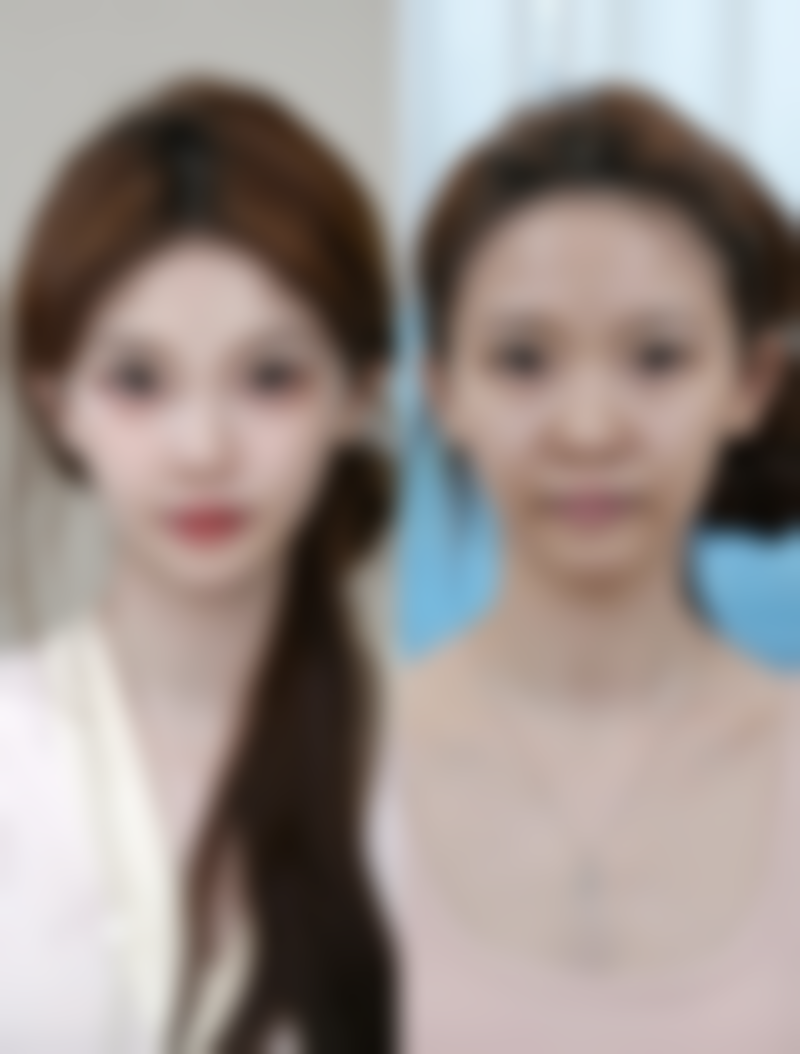 武科 大附属紫荆医院医疗美容科做全切双眼皮值不值？