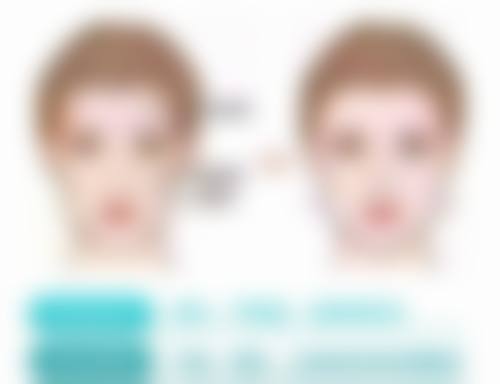 沈阳杏林整形除眼袋靠谱吗?