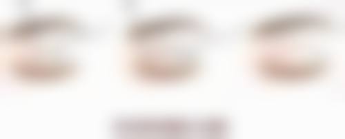 沈阳杏林整形去除胸口疤痕疙瘩适合吗？