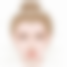 西安莲湖西交疤痕医院用同位素治疗疤痕疙瘩靠谱吗