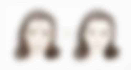 福清东南眼科医院看眼袋黑眼圈怎么样