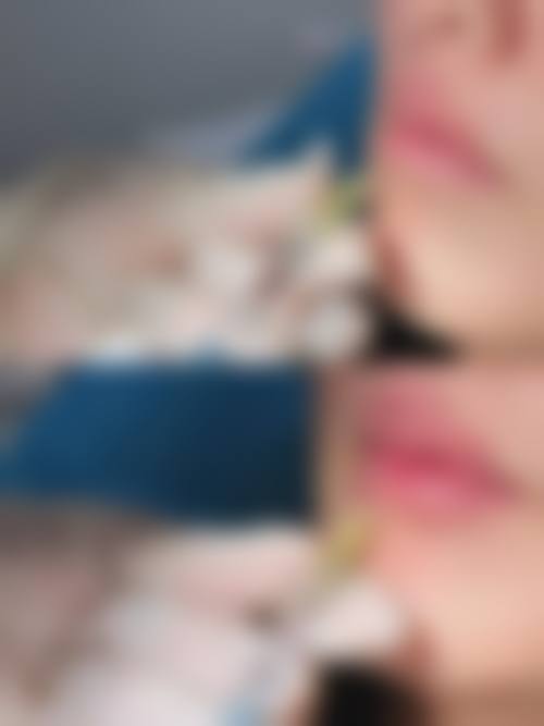 上海新生医疗美容门诊部价格表