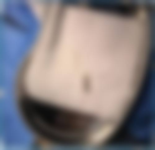 上海新生医疗美容门诊部擅长项目