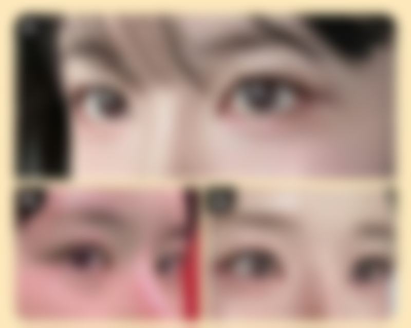 李挺医生的看诊优势