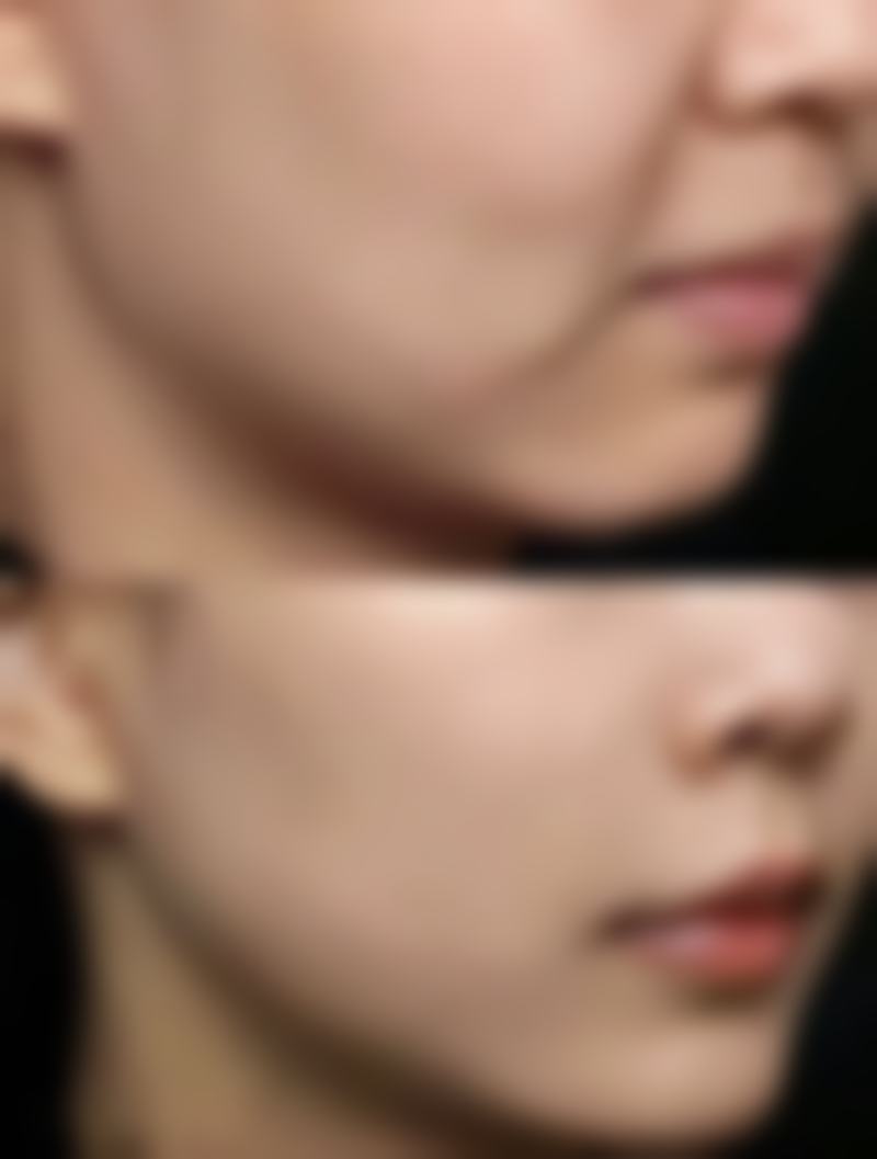 李挺医生的技术特点