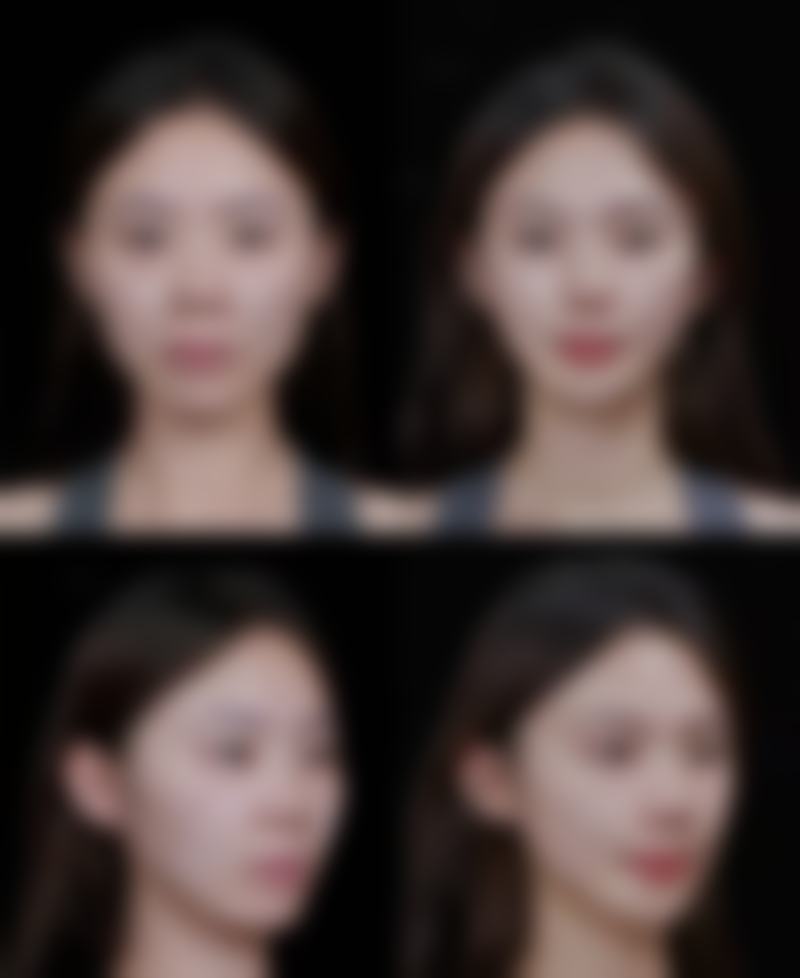 北京美清整形医疗美容诊所价格表