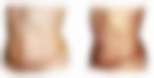 割双眼皮为什么早上起来看起来很肿？揭秘3大原因与5种消肿方法，让你的双眼皮早日恢复自然！ 