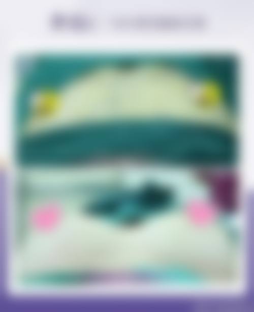 永康米斯悦整形医院真实实例:见证美丽奇迹的发生